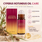 🌸 50% korting! Roll-on na het ontharen – rollerball voor gericht aanbrengen, lichte niet-vette formule & hydrateert direct. 50 ml, overal mee naartoe! ✨🧴